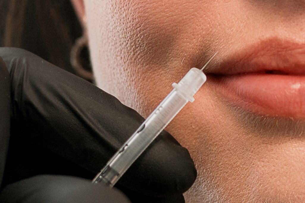 Lip Flip Nahaufnahme einer Hand mit Spritze, die sich nah an den Lippen einer Person befindet.